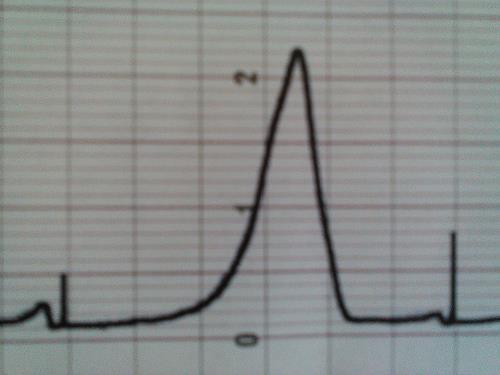 průtok mobilní fáze: 4 ml/min  13 Chromatogram