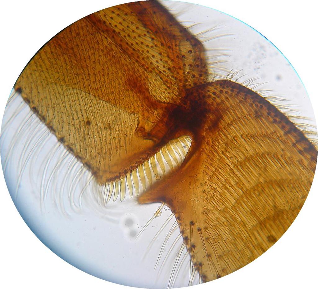 Končetina třetího páru spojení paty a holeně ( vnitřní strana ) holeň ( tibia ) chloupky pylového košíčku ( vnější strana holeně ) pylový hřeben posunovač
