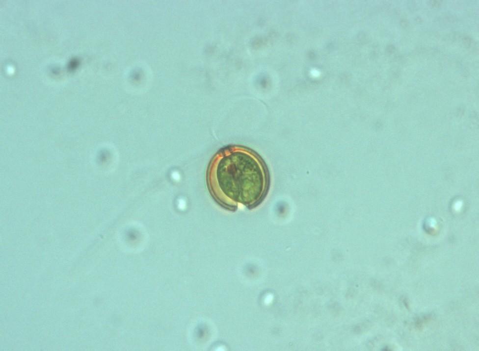 Odd.: Euglenophyta Třída: Euglenophyceae Řád: Euglenales