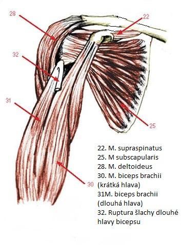 Příloha 3: Obrázek svalů v oblasti ramenního kloubu Zdroj: