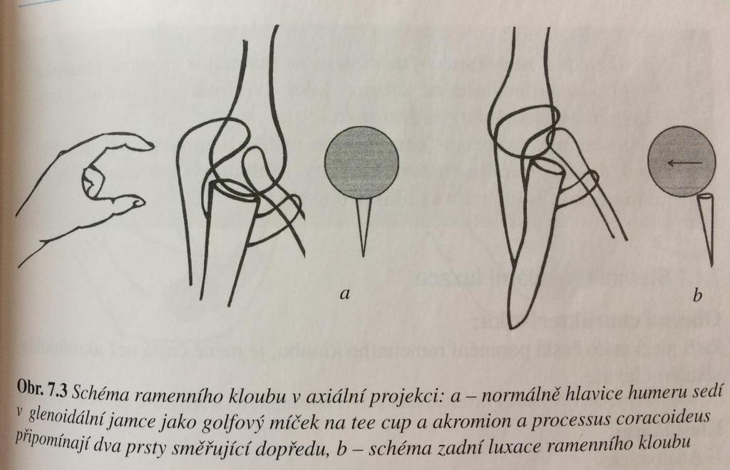 Příloha 13: Schéma axiální projekce Zdroj: Žvák,