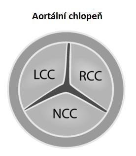 Ve svodech V3 a V4 je M vzor Hrot levé komory nebo báze levé komory Obrázek 26 - Aortální chlopeň Poslední popis bude hrotový.