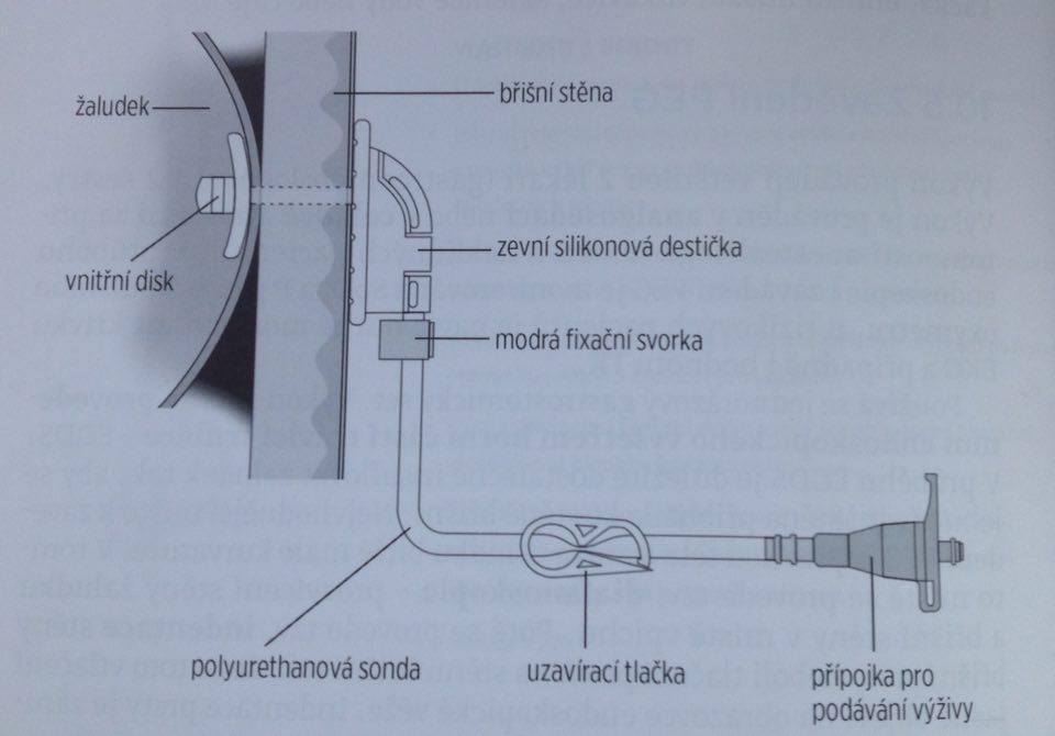 PŘÍLOHY Příloha č. 1 Schéma PEG (HOLUBOVÁ, Adéla, Helena NOVOTNÁ a Jana MAREČKOVÁ.