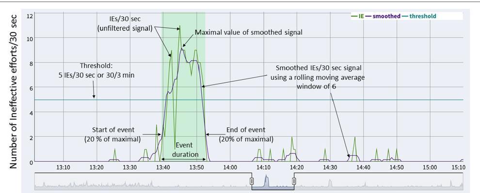 Analýza shluků (Clusters) asynchronií typu ineffective efforts (IEs) u 111 pacientů na UPV Shluky a události