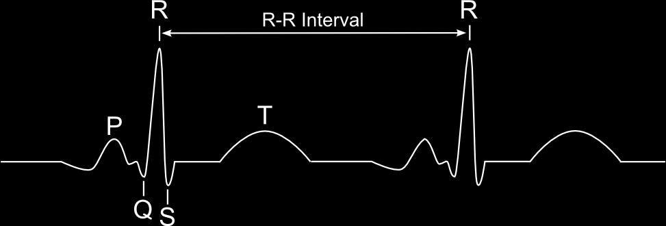 Variabilita srdečního rytmu. Definice HRV Variabilita srdečního rytmu označuje termín pro popis kolísání jak okamžitého srdečního tepu, tak RR intervalů, jak zobrazuje Obr.
