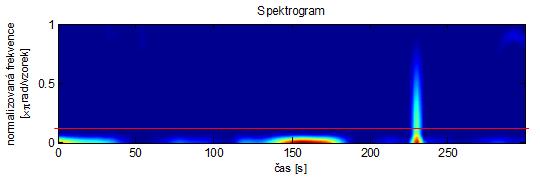 6.2. Vyhodnocení výsledků v časově-frekvenční oblasti Záměrem bylo vysledovat společný znak na výsledných spektrogramech v každé z fází, nebo alespoň rozdíly oproti fázi kontrolní.