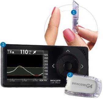 CGM (continuous