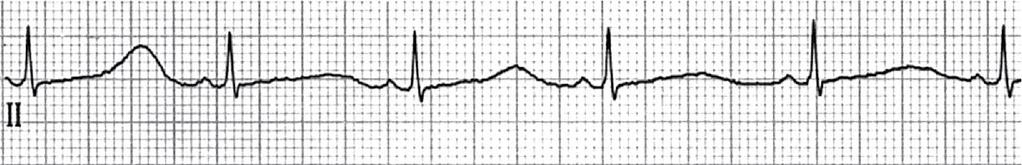 64/min http://circ.