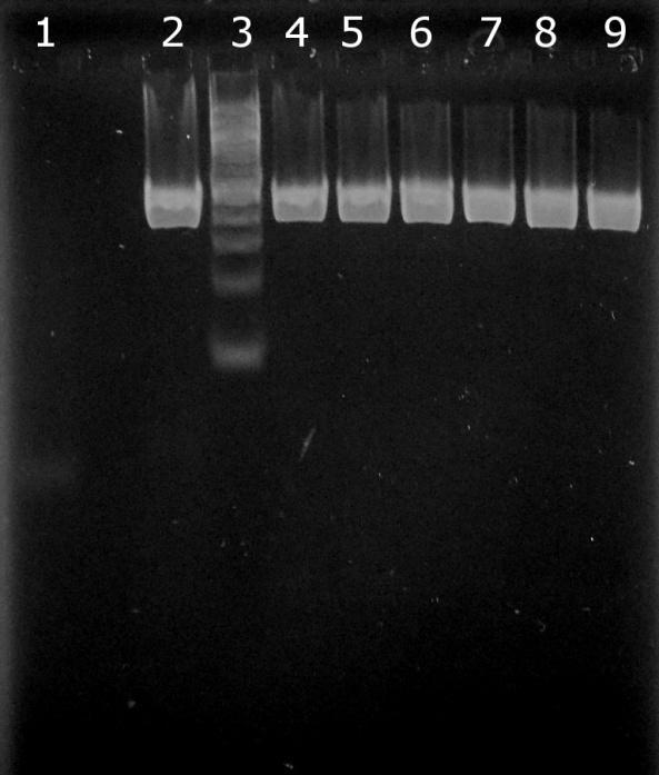 6.3 Ověření amplifikovatelnosti DNA izolované pomocí magnetických částic F-kol 135 ox v PCR Do směsi pro PCR byla použita DNA izolovaná pomocí magnetických částic F-kol 135 ox v kap. 6.2.3. 6.3.1 Ověření amplifikovatelnosti DNA v PCR pro doménu Bacteria Do směsi PCR byl nepipetován 1 μl DNA o koncentracích uvedených v tabulce k Obr.