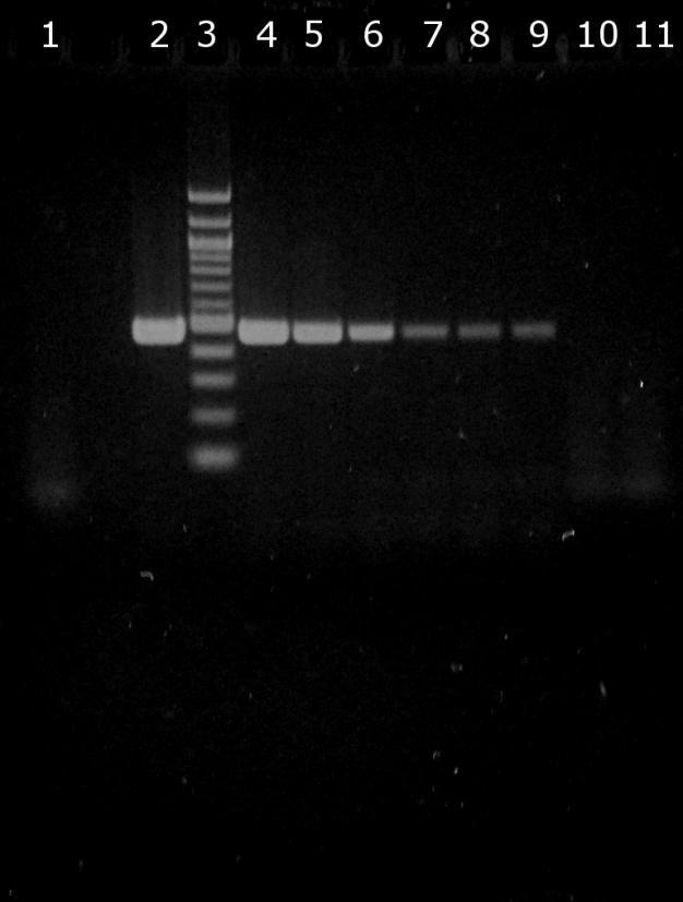 6.3.2 Ověření citlivosti PCR pro doménu Bacteria Do směsi PCR byl nepipetován 1 μl DNA o koncentracích uvedených v tabulce k Obr. 13 (10 ng-1 fg).