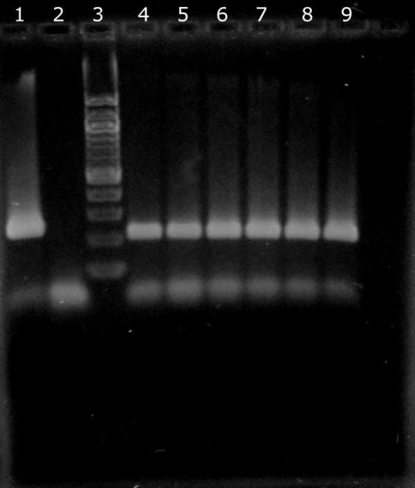 6.3.3 Ověření amplifikovatelnosti DNA v PCR pro rod Lactobacillus Do směsi PCR byl nepipetován 1 μl DNA o koncentracích uvedených v tabulce k Obr. 14 Na gel bylo naneseno 20 μl produktu PCR.