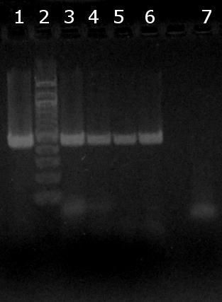 6.5 Ověření amplifikovatelnosti DNA izolované metodou fenolové extrakce a různými druhy magnetických částic v PCR Do směsí PCR byla použita DNA izolovaná pomocí metody fenolové extrakce a magn.