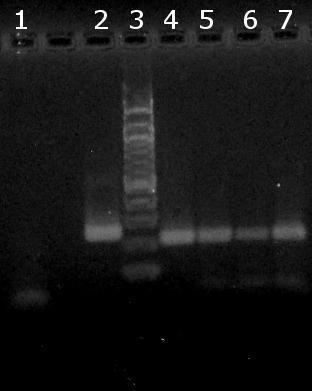 6.5.2 Ověření amplifikovatelnosti DNA v PCR pro rod Lactobacillus Do směsí PCR byl nepipetován 1 μl zředěné DNA. Na gel bylo naneseno 20 μl produktů PCR a výsledek amplifikované DNA je na Obr. 18.