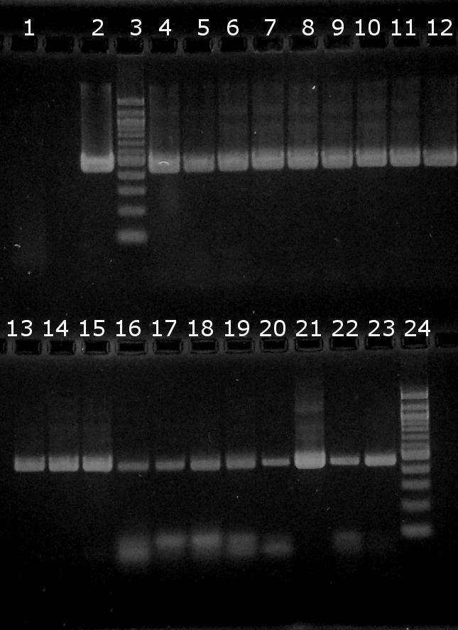 6.7 Ověření amplifikovatelnosti DNA izolované z probiotických výrobků v PCR Do směsí PCR byla použita DNA izolovaná z probiotických výrobků v kap. 6.6 6.7.1 Ověření amplifikovatelnosti DNA z probiotických výrobků v PCR pro doménu Bacteria Do směsi PCR byl nepipetován 1 μl DNA o koncentracích uvedených v Tabulce 23.