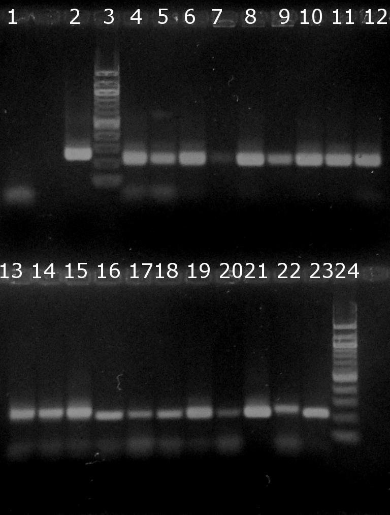 6.7.2 Ověření amplifikovatelnosti DNA z probiotických výrobků v PCR pro rod Lactobacilus Do směsi PCR byl nepipetován 1 μl DNA o koncentracích uvedených v Tabulce 23.