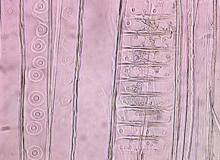 tracheid, které zpravidla bývá jednořadé (možnost párových) a častý výskyt krystalů v parenchymatických buňkách dřeňových paprsků.