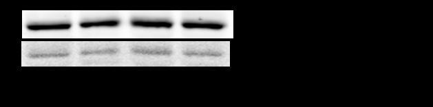 AU (pampk/ampk) 2,8 2,4 NaCl Metformin 2 1,6 1,2 0,8 0,4 0 HFD HFD+F Graf 21: Relativní poměr