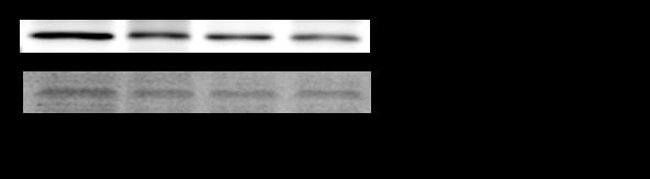 AU (pak/akt) 1,6 1,4 1,2 NaCl Metformin 1 0,8 0,6 0,4 0,2 0 HFD HFD+F Graf č.