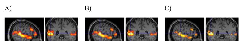 Zkoumání vlivu nepřesností v experimentální stimulaci u fmri Na základě zvolené nebo přepočtené hladiny významnosti provedeme tzv. prahování statistických parametrických map.