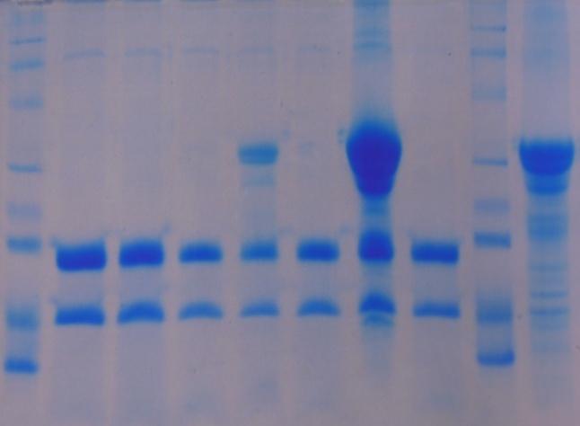 1 2 3 4 5 6 7 8 9 10 1 2 3 4 5 6 7 8 9 10 Obrázek 8: Proteinový profil vzorků zákysů získaný metodou SDS-PAGE (15% gel): část A po 24hodinové inkubaci, část B po 48hodinové inkubaci: 1: Protein Test