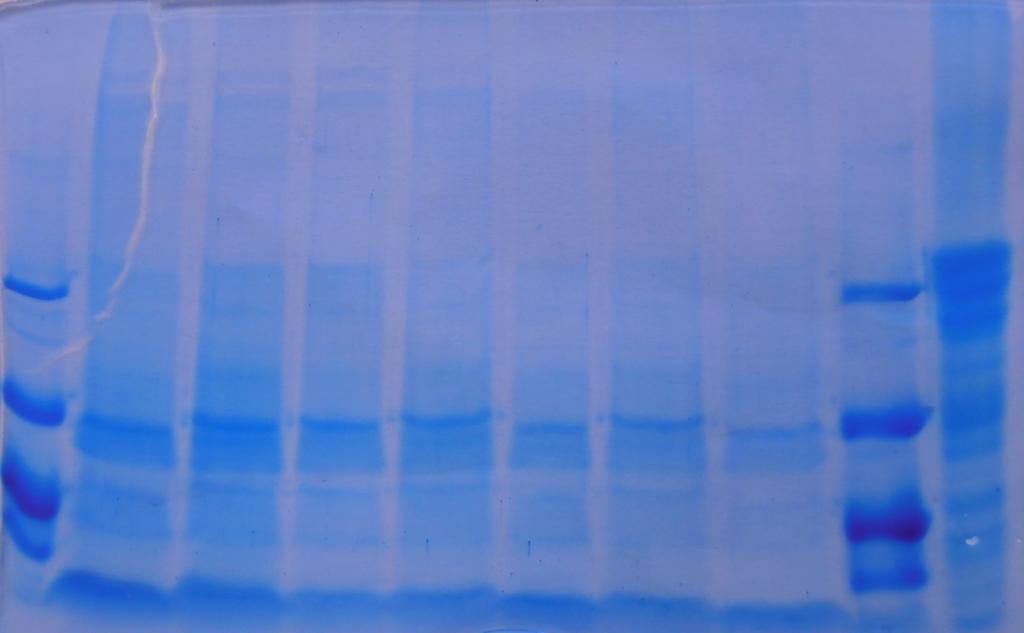 UTB ve Zlíně, Fakulta technologická 62 Na obrázku 13 je zobrazen reprezentativní gel se vzorky sýrů po 14 dnech zrání.