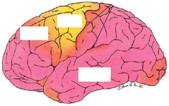 Angranular cortex Homotypical