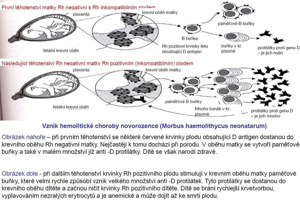 Rh faktor protilátky Protilátky anti-rh se vytvářejí až v případě inkompatibility při opakovaných krevních transfuzích nebo při inkompatibilitě matky a plodu Matka Rh a plod Rh+ (po otci) dostanouli