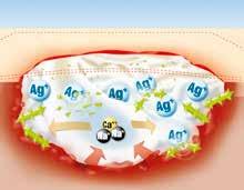 Suprasorb A + Ag Antimikrobiální kalciumalginátový obvaz n silně exsudující rány n povrchové nebo hluboké rány n rány ohrožené infekcí n ve fázi exsudace a granulace, např.