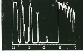 Sonografie A-zobrazení