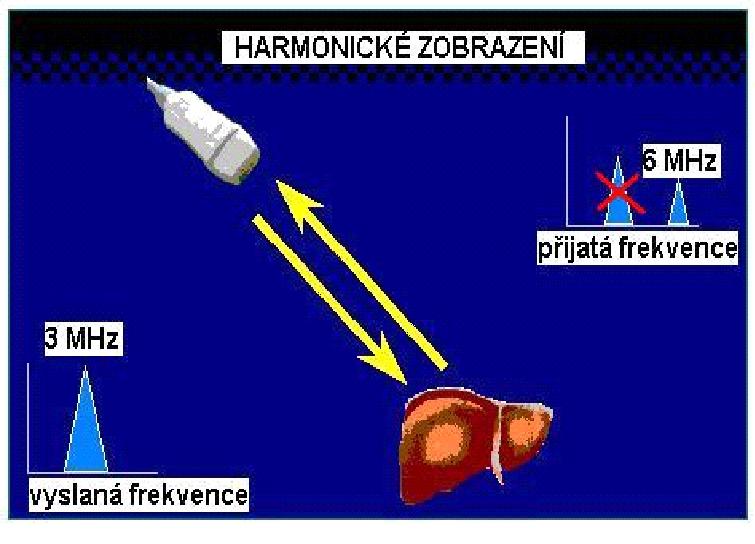 Sonografie Harmonické zobrazení Impuls o základní frekvenci f 0 je vyslán do tkáně.