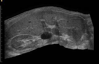 Sonografie Panoramatické zobrazení Cílem této modality je souvislé sejmutí obrazu tkáně nebo orgánu v požadovaném směru a jeho převedení do paměti přístroje Prodloužený pohled umožňuje posouzení