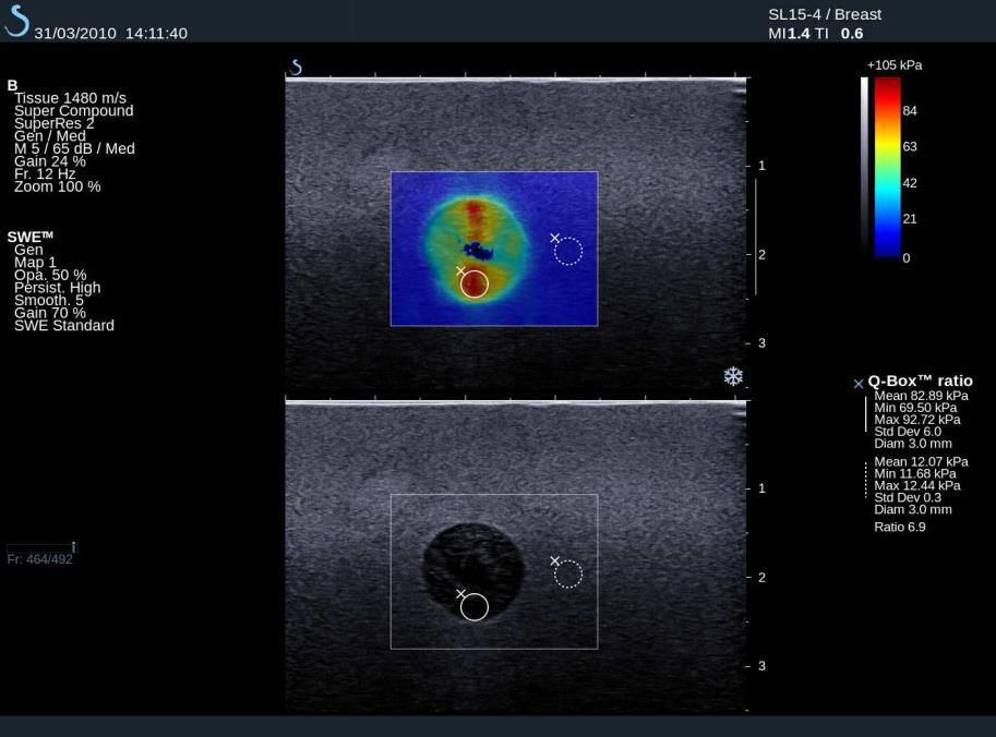 Elastografie SWE elastografie fantomu se dvěma oblastmi různé