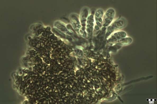 Studies in Mycology 51, 33 76. Thelebolus ellipsoideus Brumm.