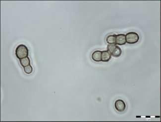 Selbmann, L. et. al. 2005.