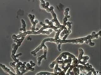 cryptoendolithic black fungi from