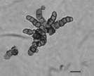 Victoria Land, Anarktida 3) 4) Elasticomyces Selbmann & Zucconi 2008
