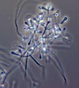 Fungi, anamorfní (mitosporní) houby, Geomyces, Geomyces pannorum -11 lokalit -procentuální výskyt vztažený k celkovému počtu analyzovaných vzorků 38,8% Antarktida - South