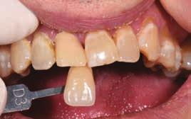 Na následujících fotografiích pacienta ukazuje zubní technik R.