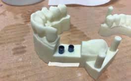 modelů. Další typem modelu jsou tzv. rohlíčky. Jedná se o model, který je určený pro výrobu transparentních ortodontických dlah.