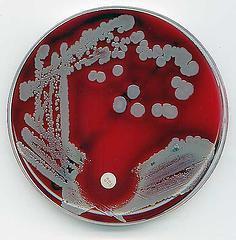 Staphylococcus aureus BSI atributivní