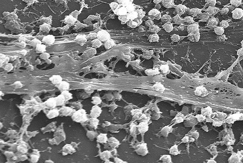 Mikroflóra kůže biofilm Biofilm