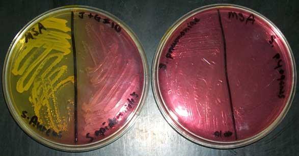 S. epidermidis vs. S. aureus koaguláza pozitivní: S.