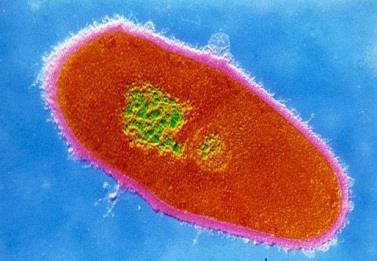 Koryneformní bakterie G+ pleomorfní bakterie