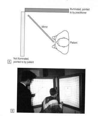 INKOMITANTNÍ STRABISMUS - PDF Free Download