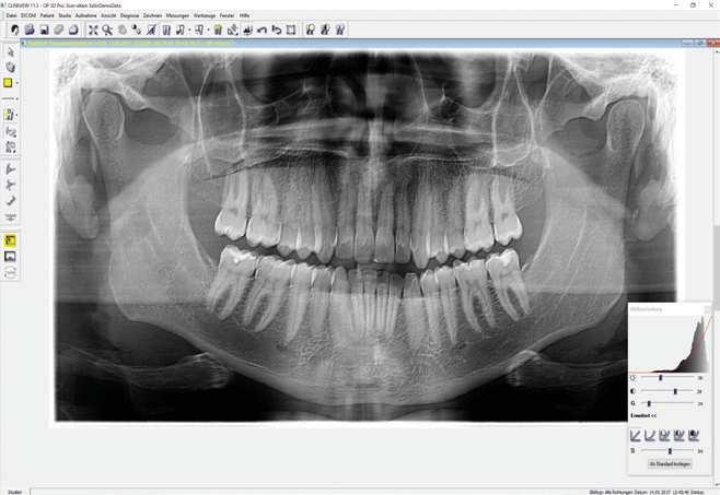 Kromě toho budete připraveni používat novou sjednocující softwarovou platformu DTX Studio * pro 2D a 3D diagnostiku, která představuje novou éru digitální integrace pracovních postupů.