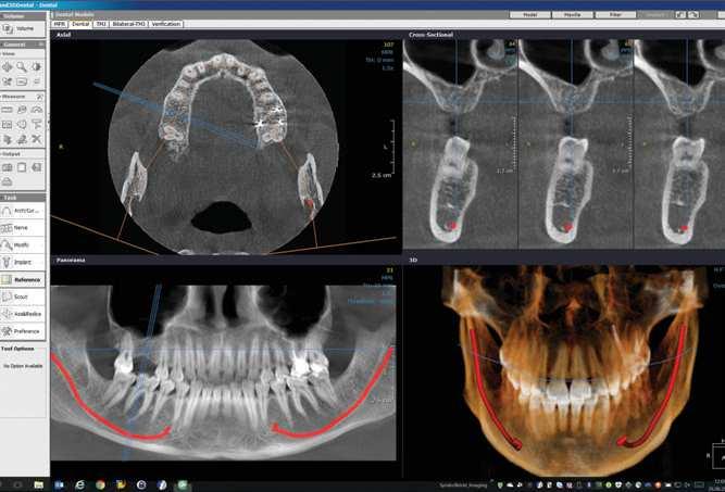 řešení do jednoho integrovaného pracovního procesu. Software CLINIVIEW je platformou DTX Studio.