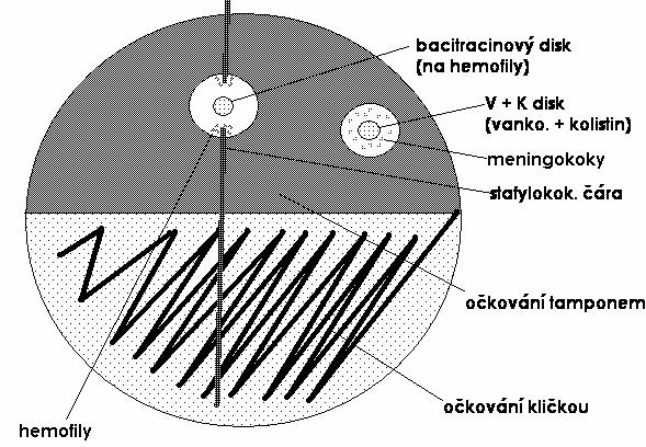 Močové cesty Escherichia coli a další enterobaktérie, enterokoky, Streptococcus agalactiae, kvasinky, stafylokoky, některé viry, vzácně paraziti Pohlavní orgány Kapavka, syfilis, Haemophilus ducreyi,