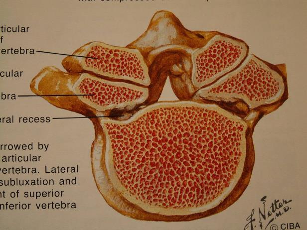 Anatomická klasifikace stenózy
