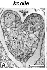 Buněčné dělení mutace knolle porucha cytokineze KNOLLE =