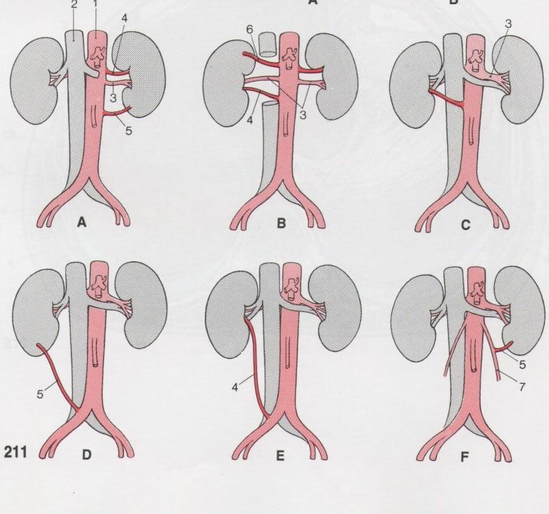 tepny 2/3 populace má oboustranně jedinou renální tepnu, která odstupuje ve výši L1 až L2. Pravá a.